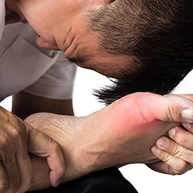 Arthritis foot pain